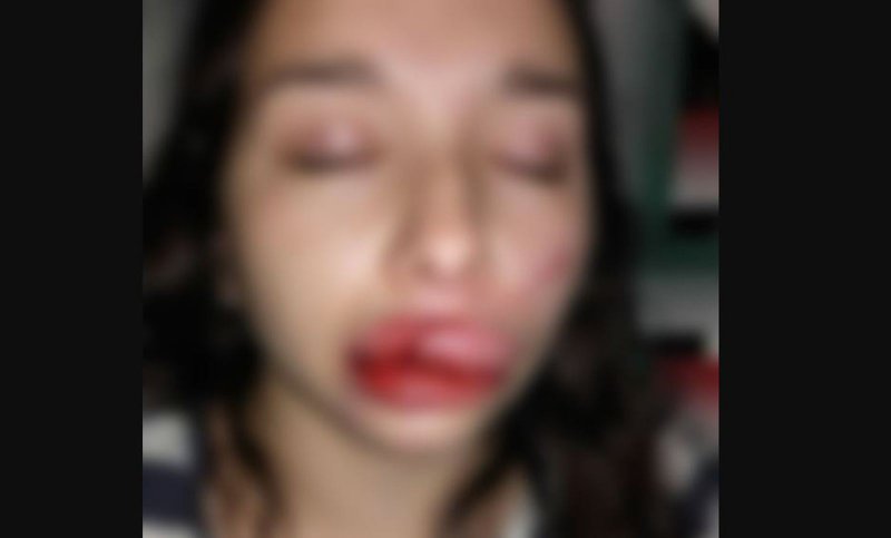 Una joven se resiste a una violación grupal y los agresores la desfiguran a golpes.